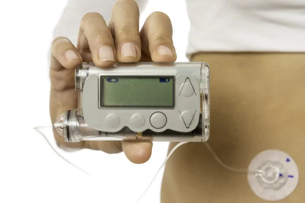 Hand holding an insulin pump